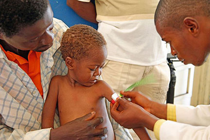 Medical staff examine a child for signs of malnourishment in DRC, from https://commons.wikimedia.org/wiki/File:Medical_staff_examine_a_child_for_signs_of_malnourishment_in_DRC_(7610291856).jpg Russell Watkins/Department for International Development/Wikimedia Commons
